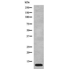 兔抗MT-ATP8多克隆抗体