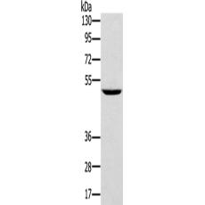 兔抗TRIM31多克隆抗体