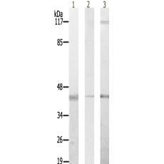 兔抗PPP1R2(Ab-44)多克隆抗体