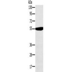 兔抗OXCT1多克隆抗体