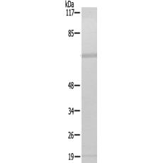 兔抗PDGFRB(Ab-771)多克隆抗体