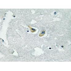 兔抗NCF1(Phospho-Ser345)多克隆抗体