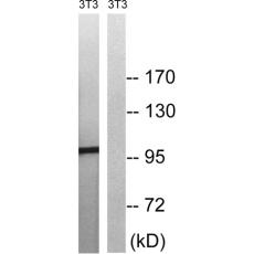 兔抗MERTKTYRO3(Phospho-Tyr749681)多克隆抗体
