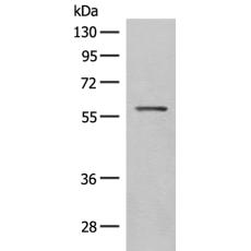 兔抗SLC5A1多克隆抗体