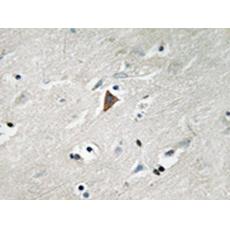 兔抗PDPK1(Phospho-Tyr9)多克隆抗体
