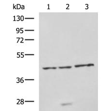 兔抗NDRG4多克隆抗体
