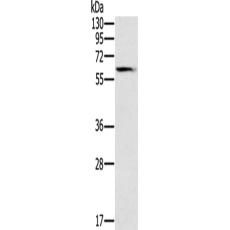 兔抗SLC45A3多克隆抗体
