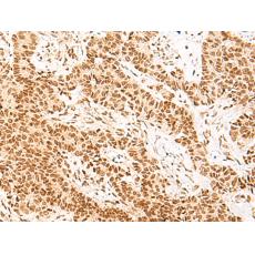 兔抗NHP2多克隆抗体