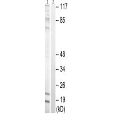 兔抗STMN1(Phospho-Ser62) 多克隆抗体