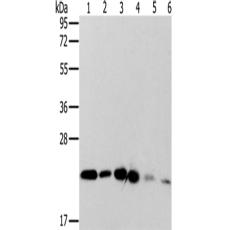 兔抗MRPL11多克隆抗体