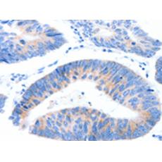 兔抗MUC3A多克隆抗体