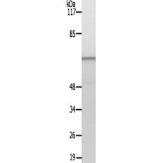 兔抗MAPT(Ab-534217)多克隆抗体