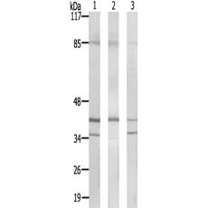 兔抗PRPF18多克隆抗体