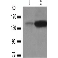 兔抗PLCG1 (Phospho-Tyr783)多克隆抗体