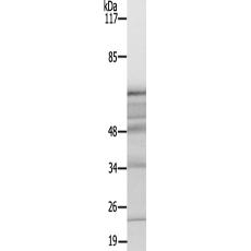 兔抗MAPT(Ab-717400)多克隆抗体