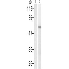 兔抗SMAD2 (Phospho-Thr220)多克隆抗体
