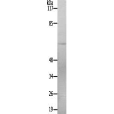 兔抗STK39(Ab-325)多克隆抗体