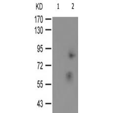 兔抗NR3C1(Phospho-Ser203)多克隆抗体