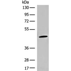 兔抗SLC37A4多克隆抗体