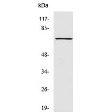 兔抗SYK(Phospho-Tyr525)多克隆抗体