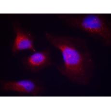 兔抗SYK (phospho-Tyr323)多克隆抗体