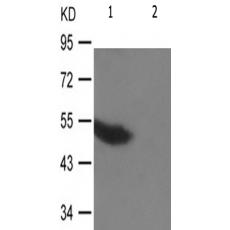 兔抗TP53(Phospho-Ser20)多克隆抗体