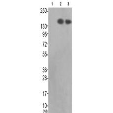 兔抗MET(Ab-1313)多克隆抗体
