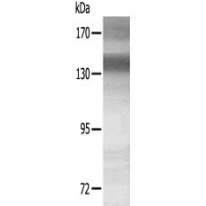 兔抗MET(Ab-1234)多克隆抗体