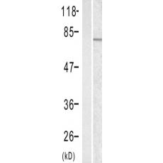 兔抗RELA(phospho-Ser311)多克隆抗体