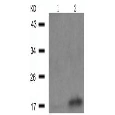 兔抗SNCA (Phospho-Tyr125)多克隆抗体