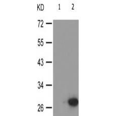 兔抗TNNI3(Phospho-Thr142)多克隆抗体