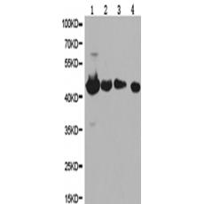 兔抗PTPN2多克隆抗体