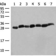 兔抗PSMA3多克隆抗体