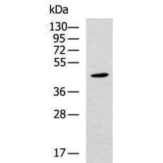 兔抗SAP30BP多克隆抗体