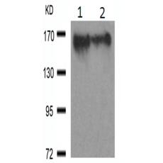 兔抗MAP3K5(Ab-966)多克隆抗体
