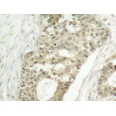 兔抗PRKCD (Phospho-Ser645)多克隆抗体