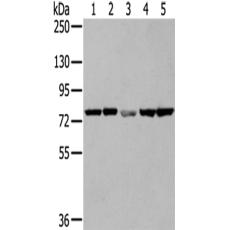 兔抗TGM5多克隆抗体