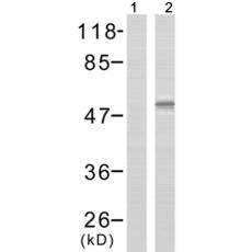 兔抗SRC(Phospho-Tyr418)多克隆抗体