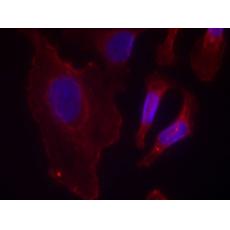 兔抗PLCG2 (Phospho-Tyr753)多克隆抗体