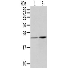 兔抗RBP4多克隆抗体