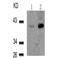 兔抗NFKBIE (Phospho-Ser22)多克隆抗体