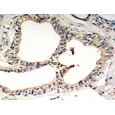 兔抗NFKBIE (Phospho-Ser22)多克隆抗体