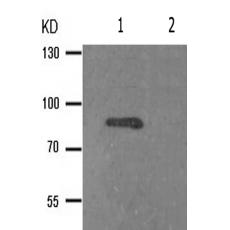  兔抗GYS1(Phospho-Ser645) 多克隆抗体 