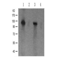 兔抗PRKD1 (Phospho-Ser910)多克隆抗体