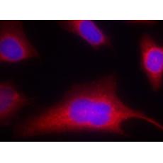 兔抗PRKD1 (Phospho-Ser910)多克隆抗体
