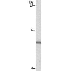   兔抗GUCY1B3多克隆抗体 