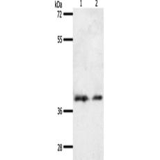 兔抗SSTR1多克隆抗体