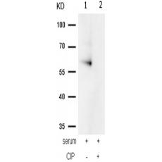 兔抗PRKAA1 PRKAA2(Phospho-Thr183 Thr172)多克隆抗体 