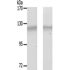 兔抗PTK2(Ab-843)多克隆抗体