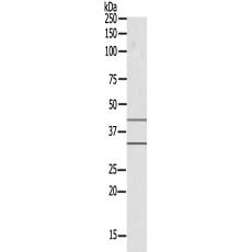 兔抗MED27多克隆抗体